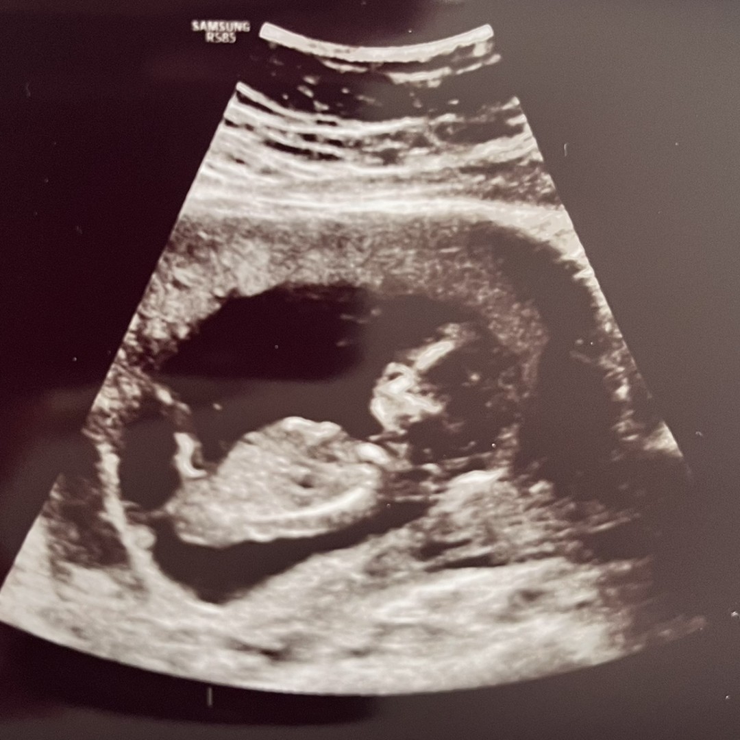 Photo shared by Lívia for their Babylist baby registry.