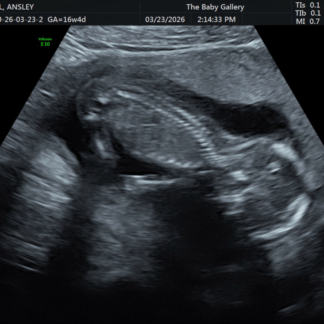 Photo shared by Ansley for their Babylist baby registry.