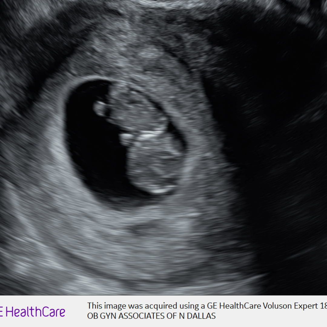 Photo shared by Freya for their Babylist baby registry.