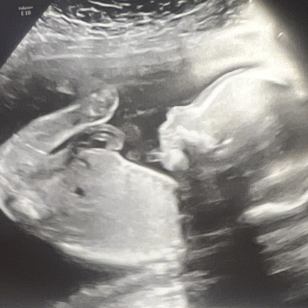 Photo shared by Taylor for their Babylist baby registry.