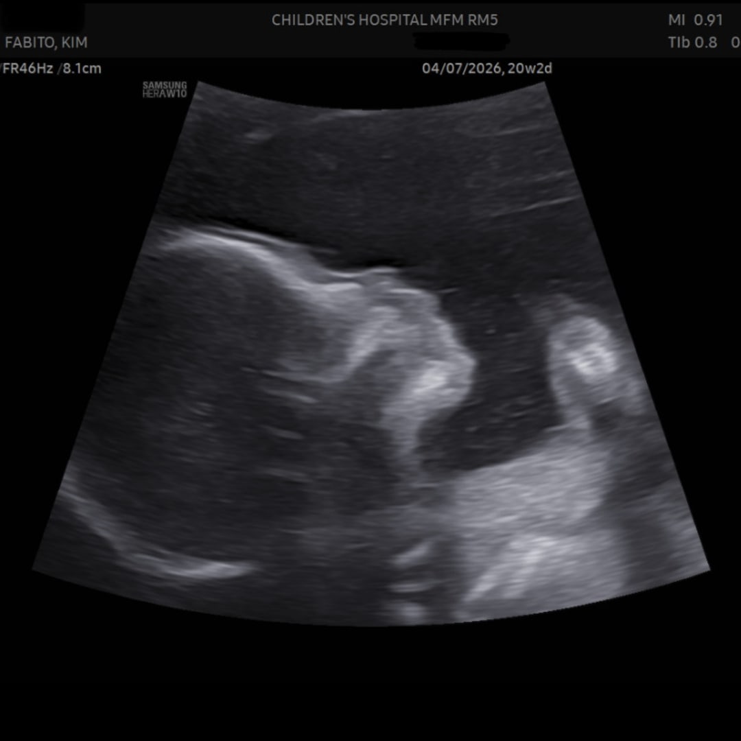 Photo shared by Kim for their Babylist baby registry.