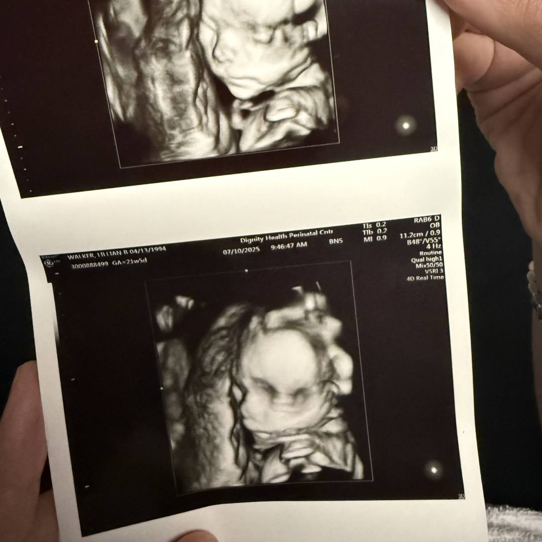 Photo shared by Lillian for their Babylist baby registry.