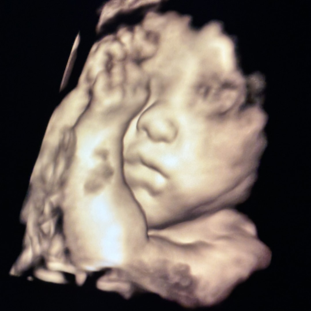 Photo shared by Alyssa for their Babylist baby registry.