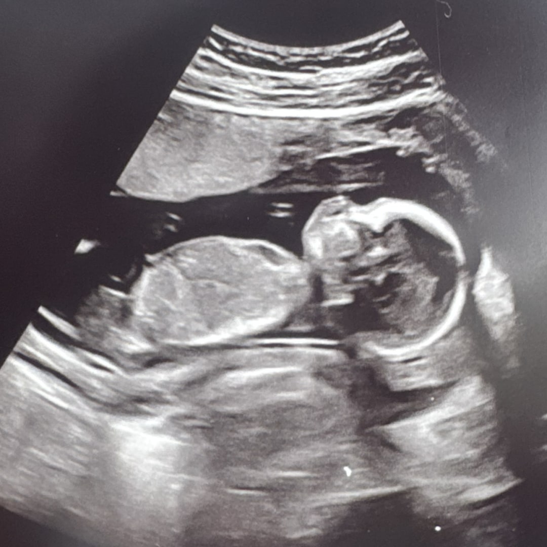 Photo shared by Danielle for their Babylist baby registry.