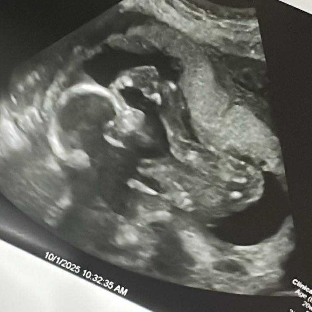 Photo shared by Chloe for their Babylist baby registry.