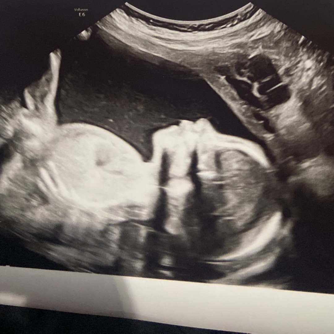 Photo shared by Becky for their Babylist baby registry.