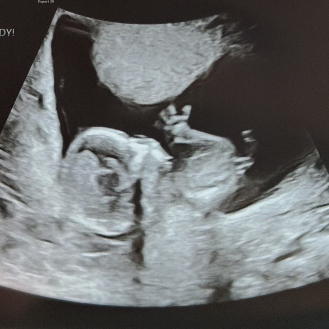 Photo shared by Ashley & CJ for their Babylist baby registry.