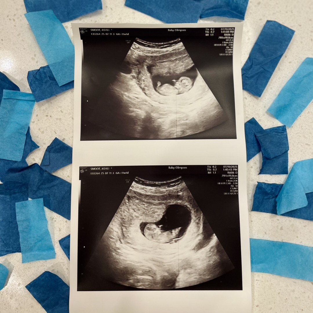 Photo shared by Ashli & Zack for their Babylist baby registry.