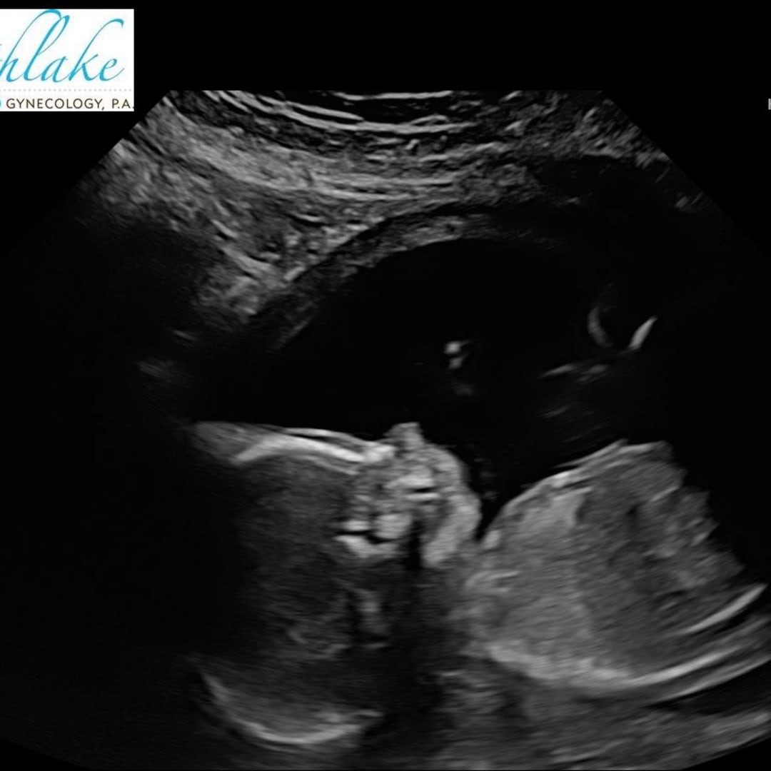 Photo shared by Emily for their Babylist baby registry.