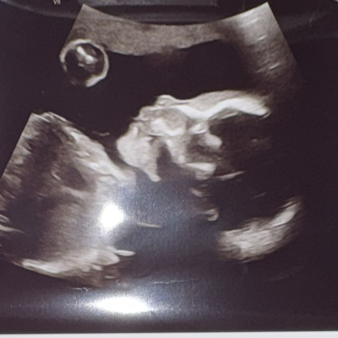 Photo shared by Angela for their Babylist baby registry.