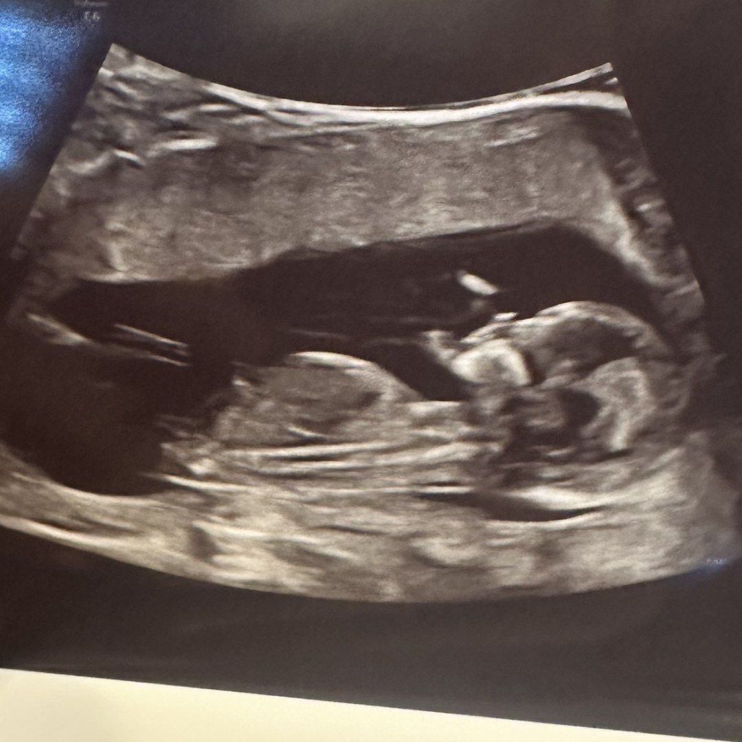 Photo shared by Brianna for their Babylist baby registry.