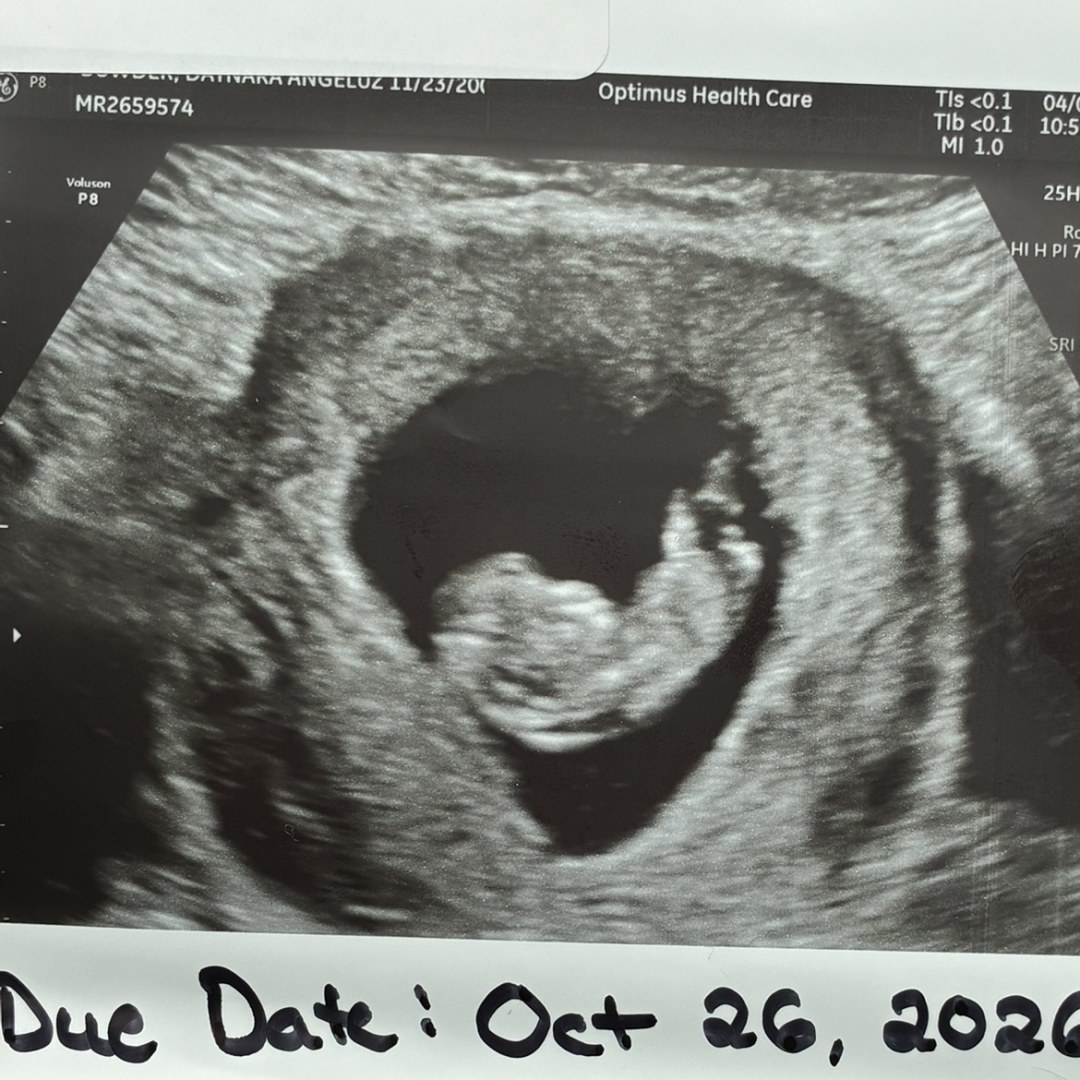 Photo shared by Daynara for their Babylist baby registry.
