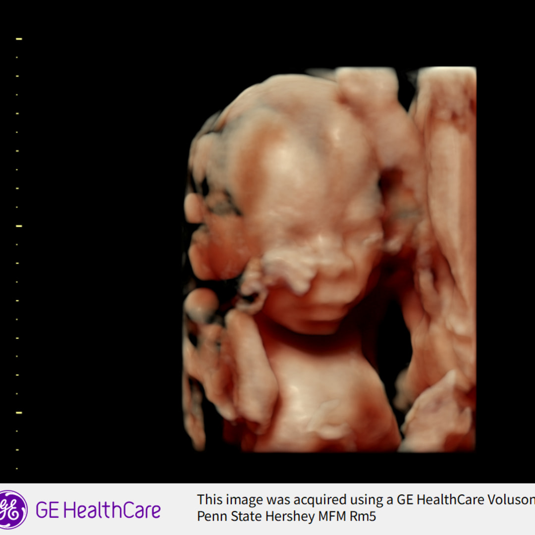 Photo shared by Emily for their Babylist baby registry.