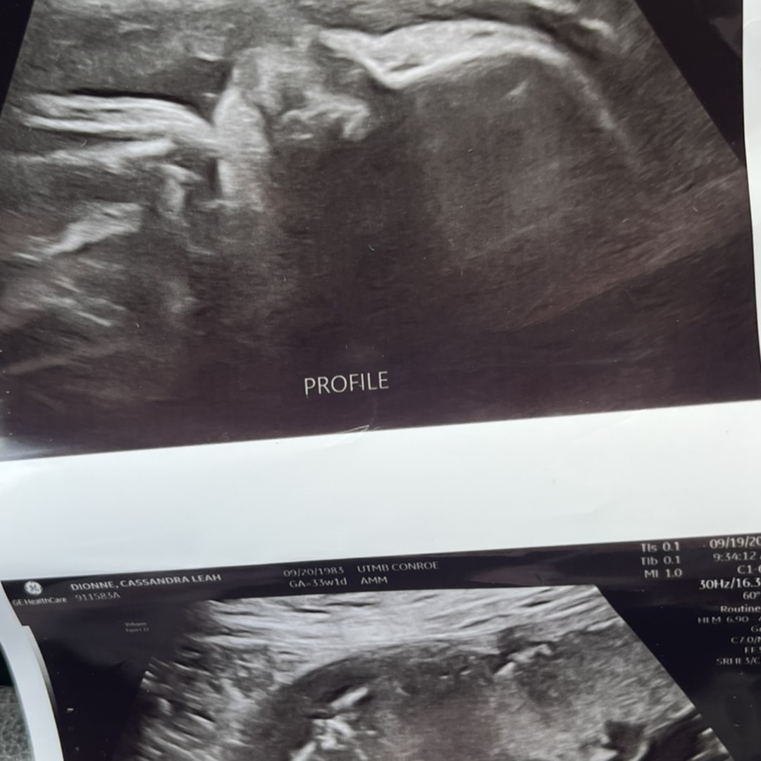 Photo shared by Cassandra for their Babylist baby registry.