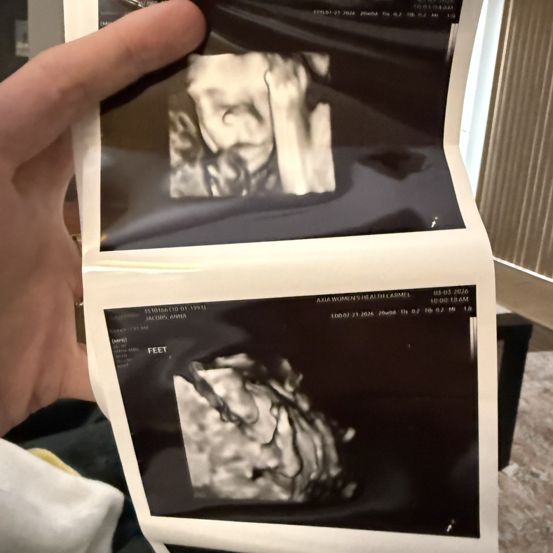 Photo shared by Anna for their Babylist baby registry.