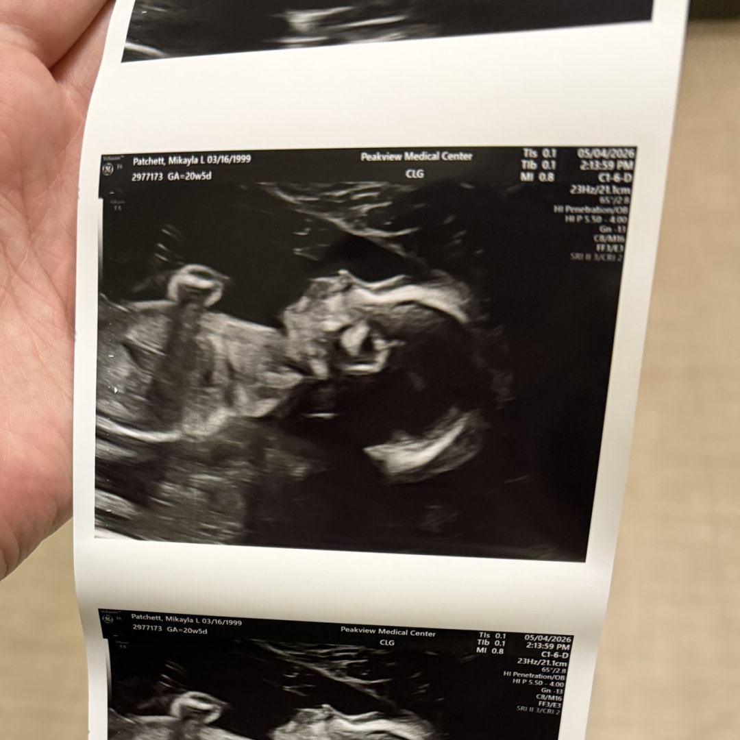 Photo shared by Mikayla for their Babylist baby registry.