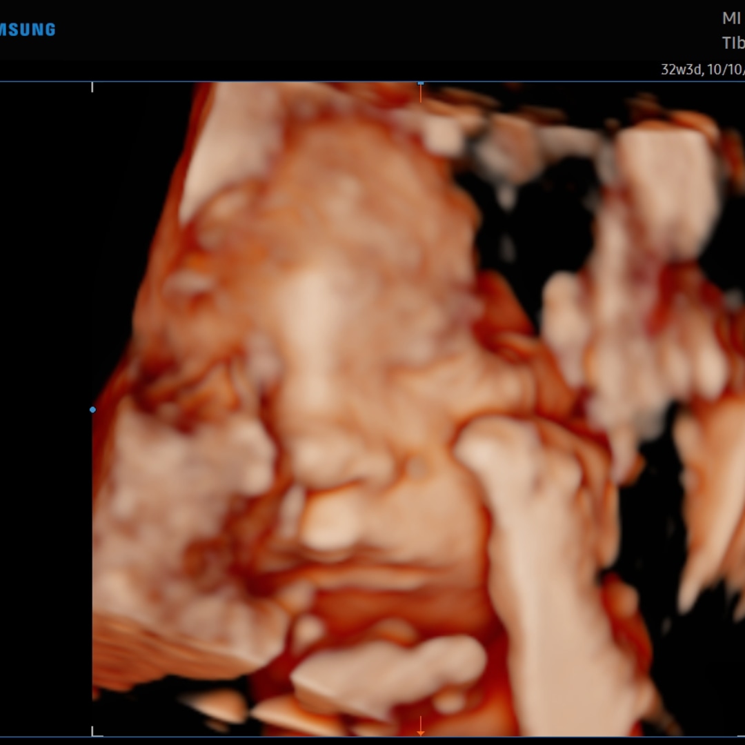 Photo shared by Ashtin for their Babylist baby registry.