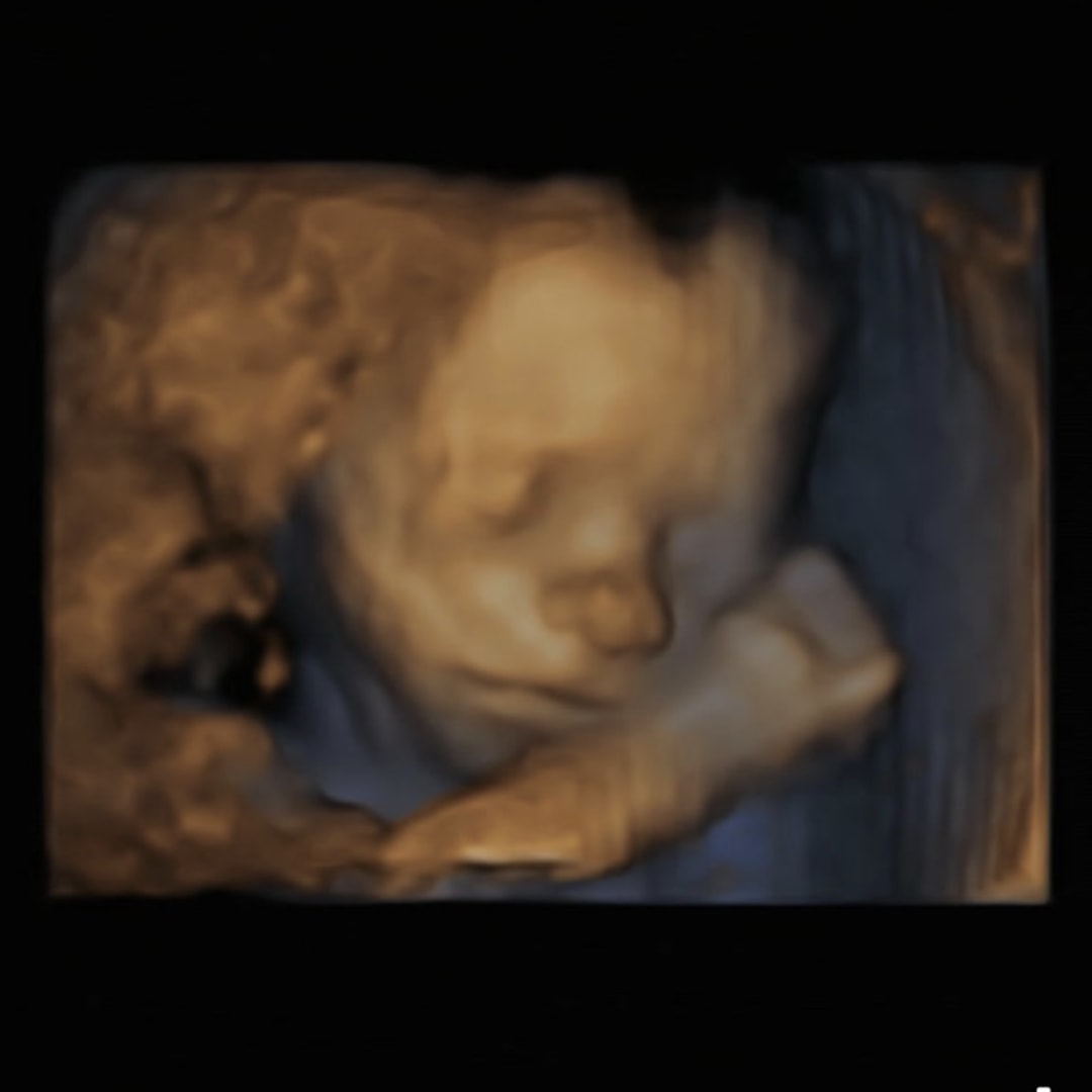 Photo shared by Makenna for their Babylist baby registry.