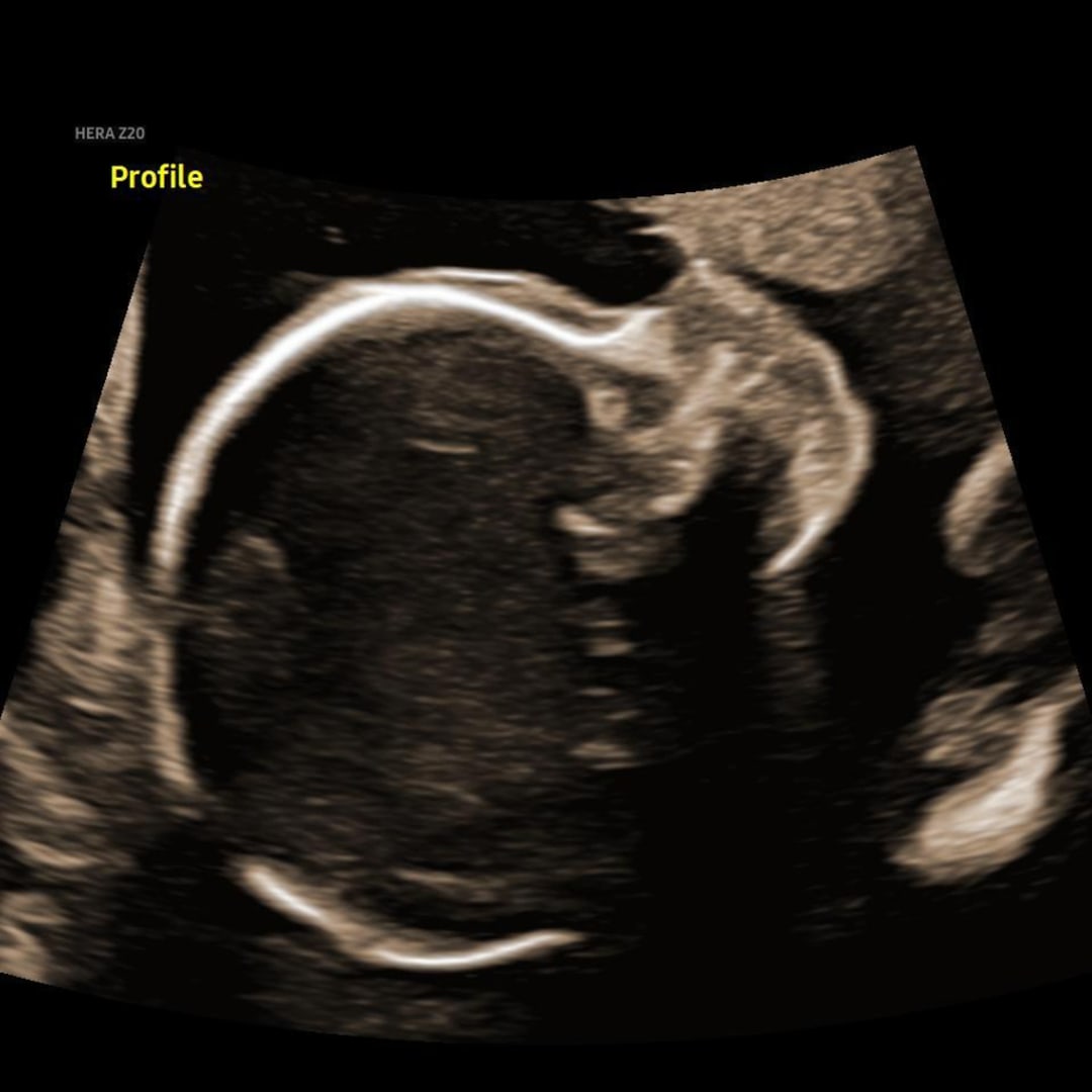 Photo shared by Francine for their Babylist baby registry.