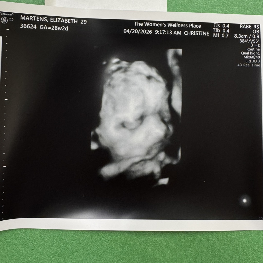 Photo shared by Elizabeth for their Babylist baby registry.