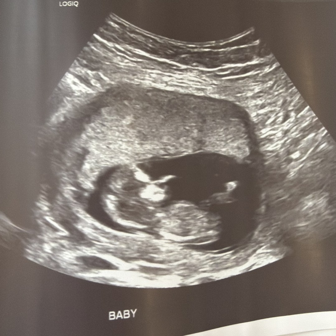 Photo shared by Lauren for their Babylist baby registry.