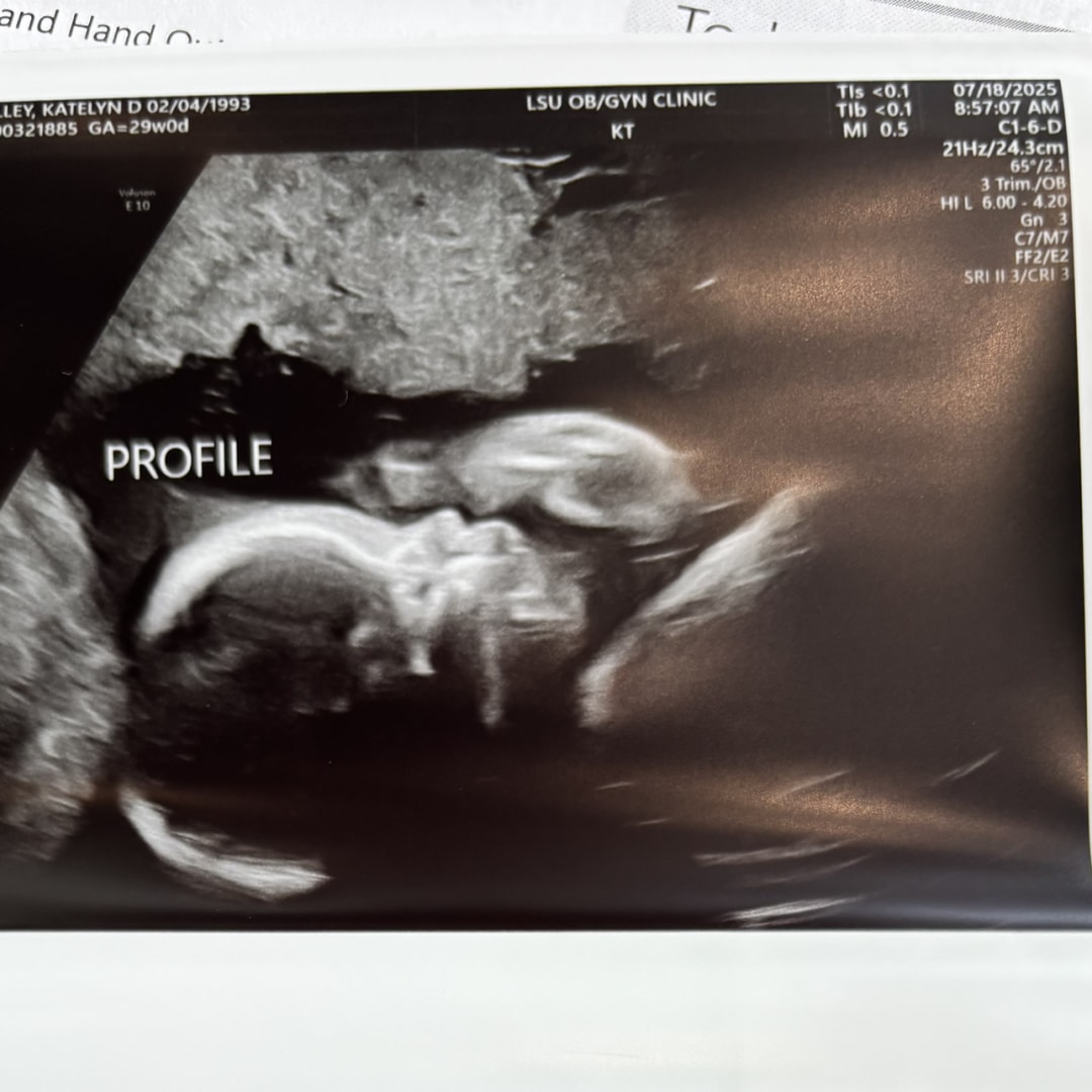 Photo shared by Katie for their Babylist baby registry.