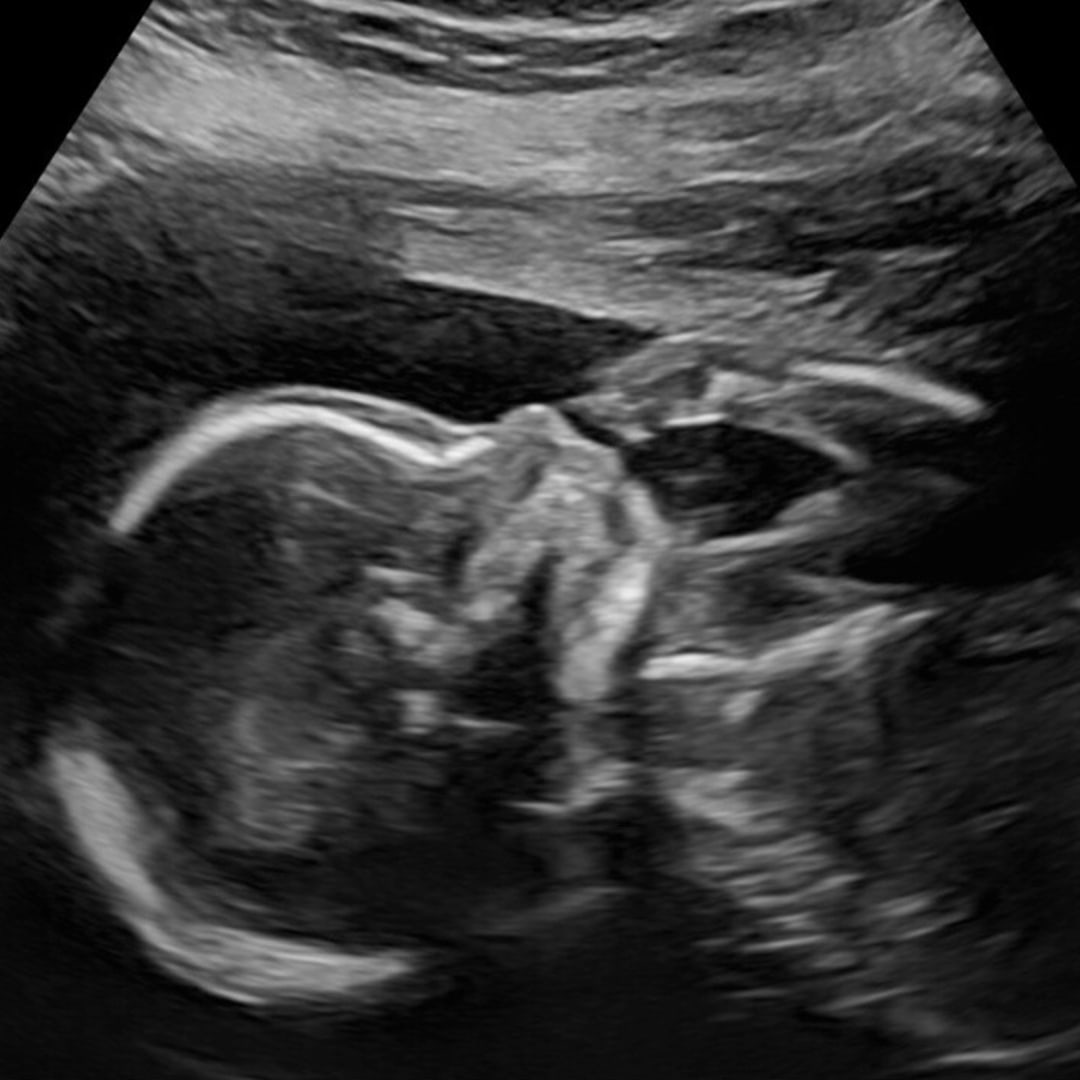 Photo shared by Delaney for their Babylist baby registry.