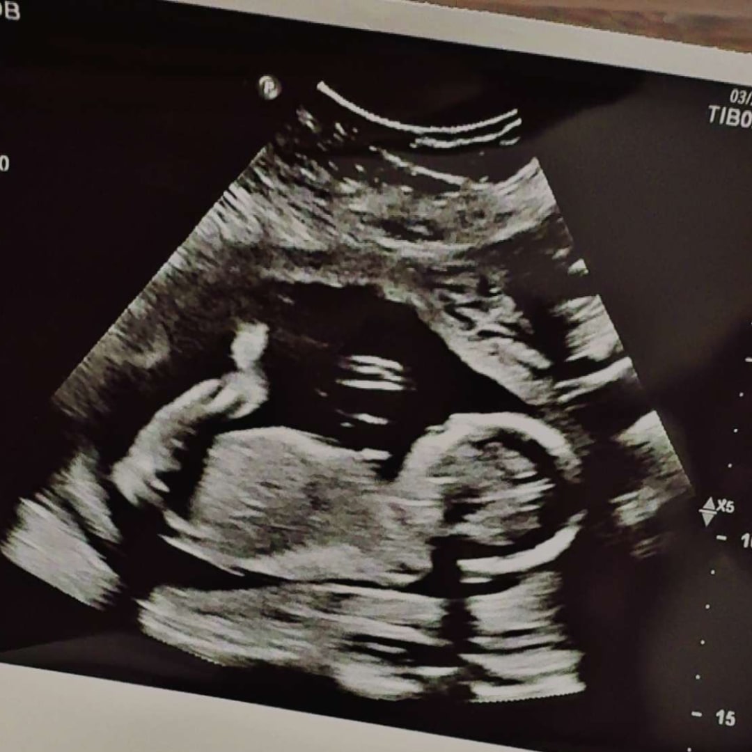 Photo shared by Kimberly for their Babylist baby registry.