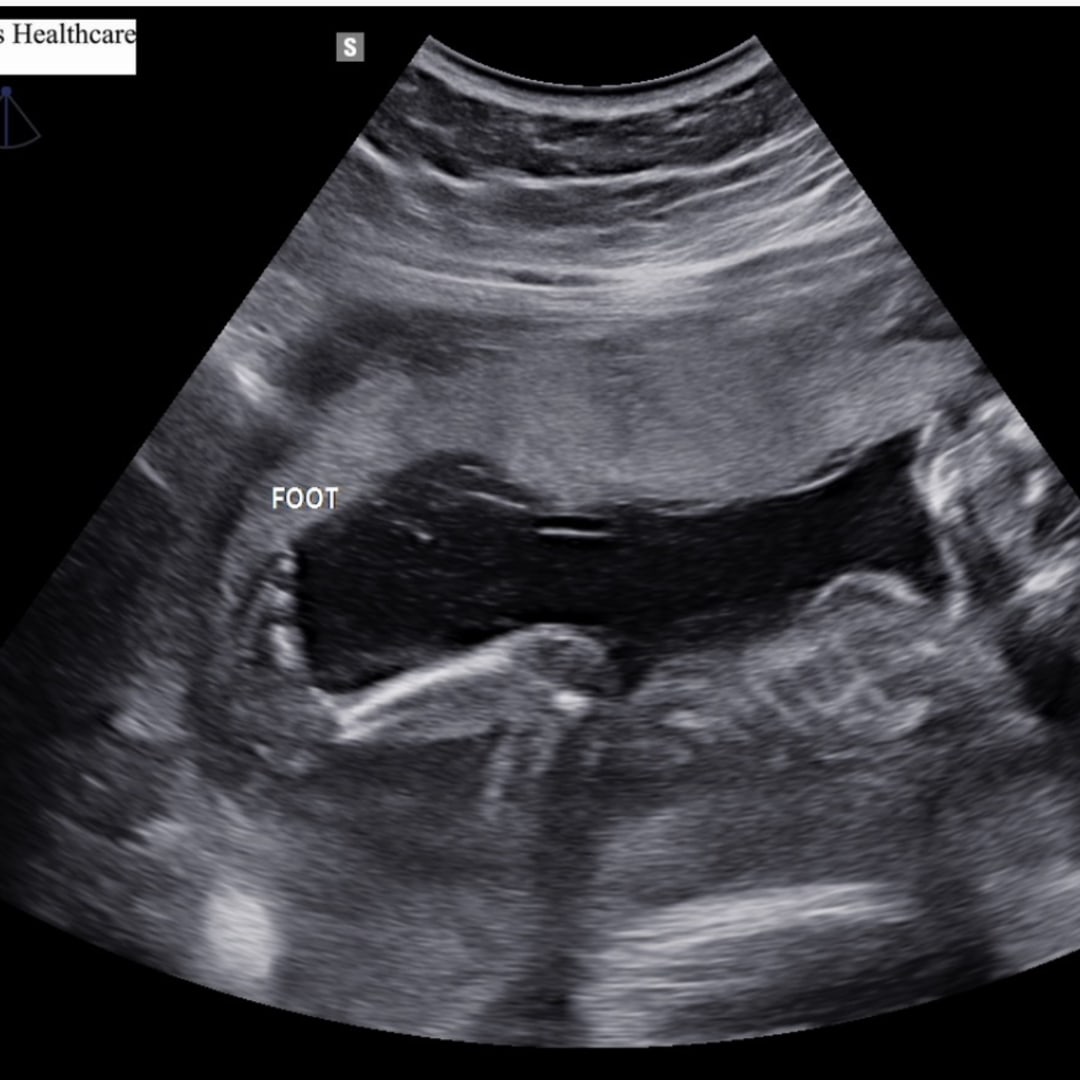 Photo shared by Riley for their Babylist baby registry.