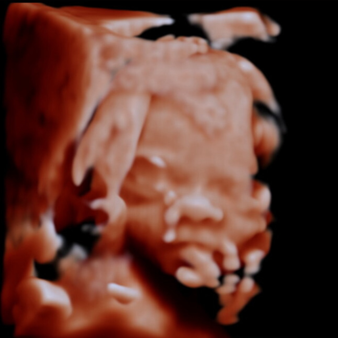 Photo shared by Tara for their Babylist baby registry.