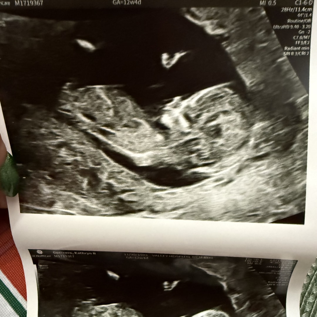 Photo shared by Kathryn for their Babylist baby registry.