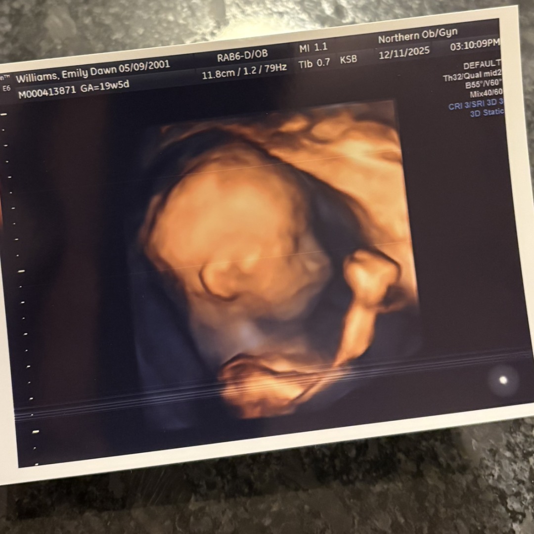 Photo shared by Emily for their Babylist baby registry.