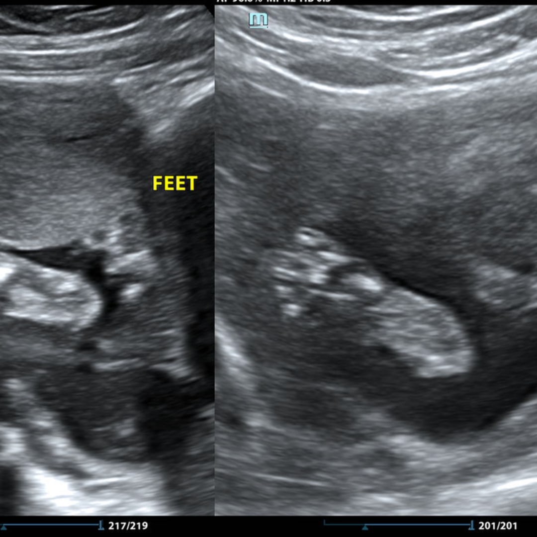 Photo shared by Clarisa for their Babylist baby registry.