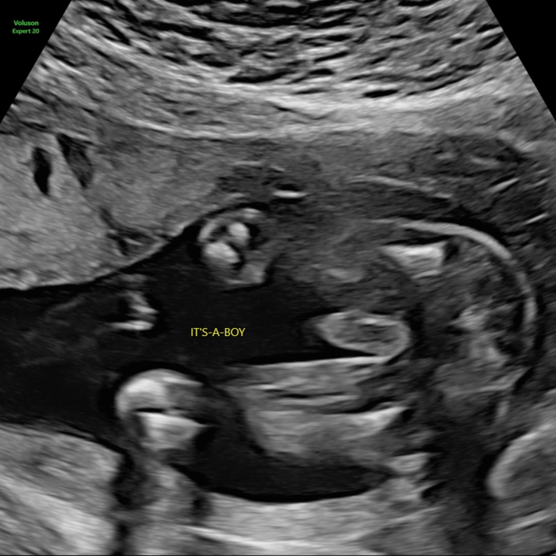 Photo shared by Roshel for their Babylist baby registry.