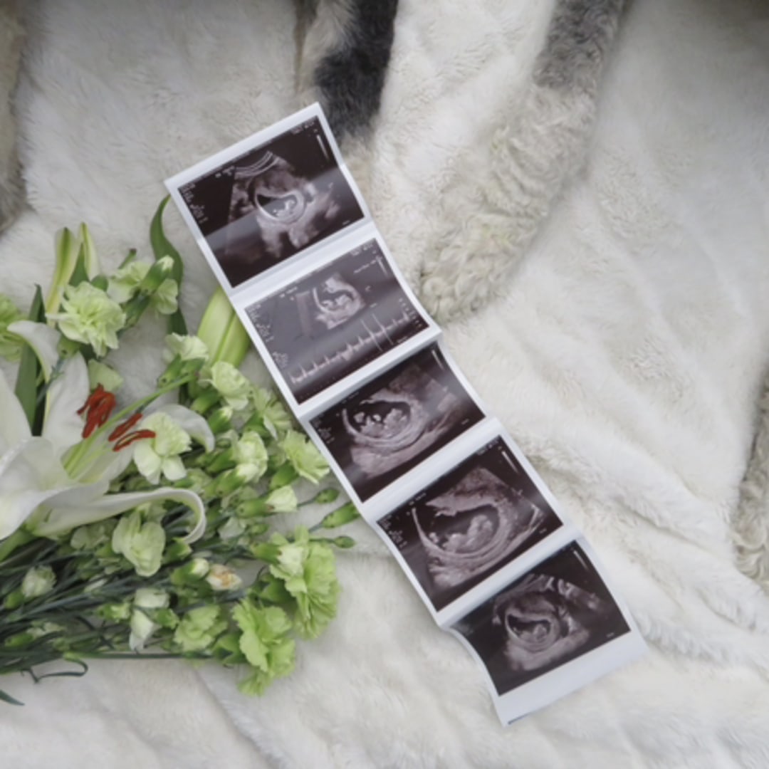 Photo shared by Katherine and Ben for their Babylist baby registry.
