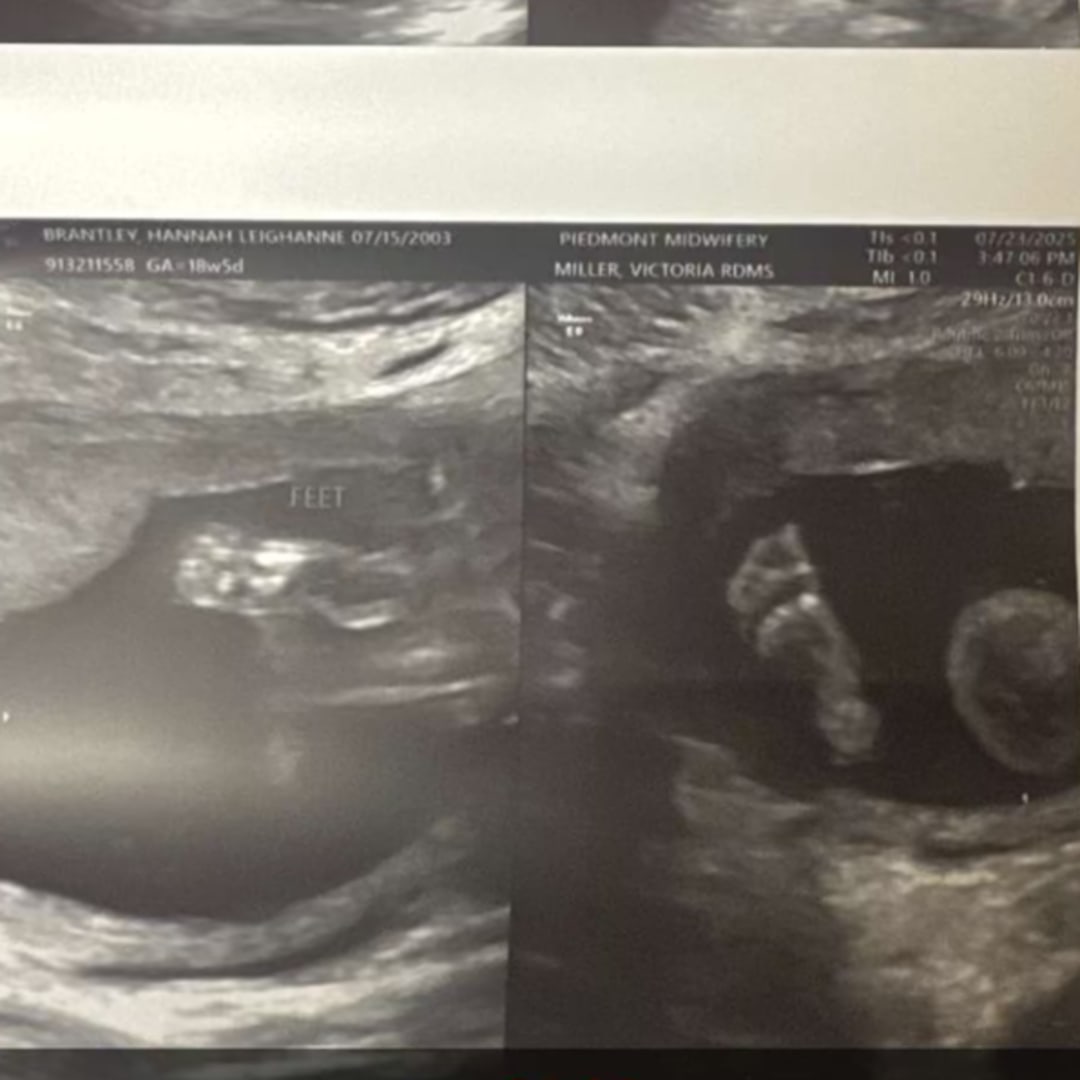 Photo shared by Hannah for their Babylist baby registry.