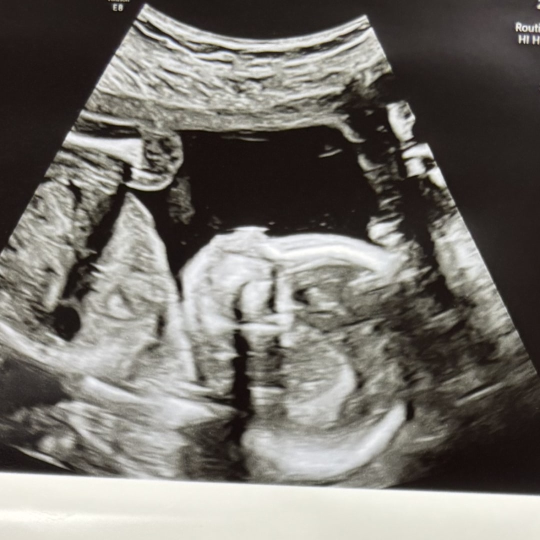 Photo shared by Hailey for their Babylist baby registry.