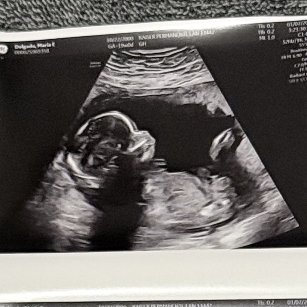 Photo shared by Elena for their Babylist baby registry.