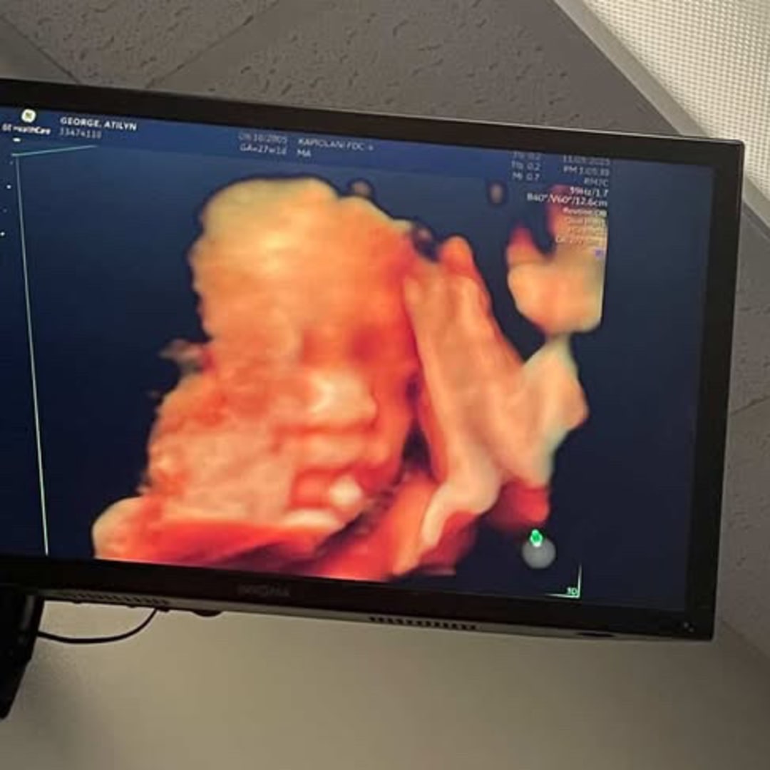 Photo shared by Atilyn for their Babylist baby registry.