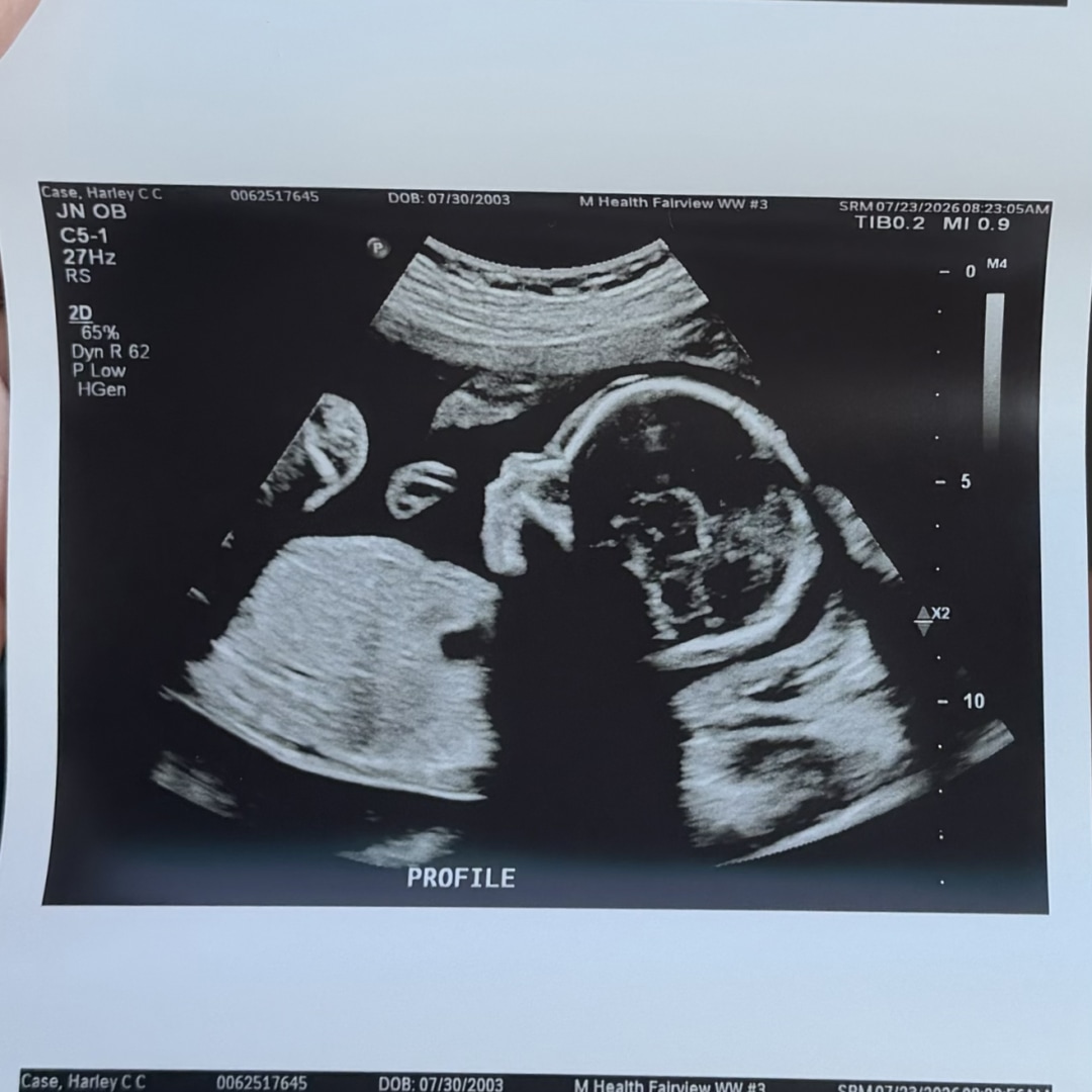 Photo shared by Harley for their Babylist baby registry.