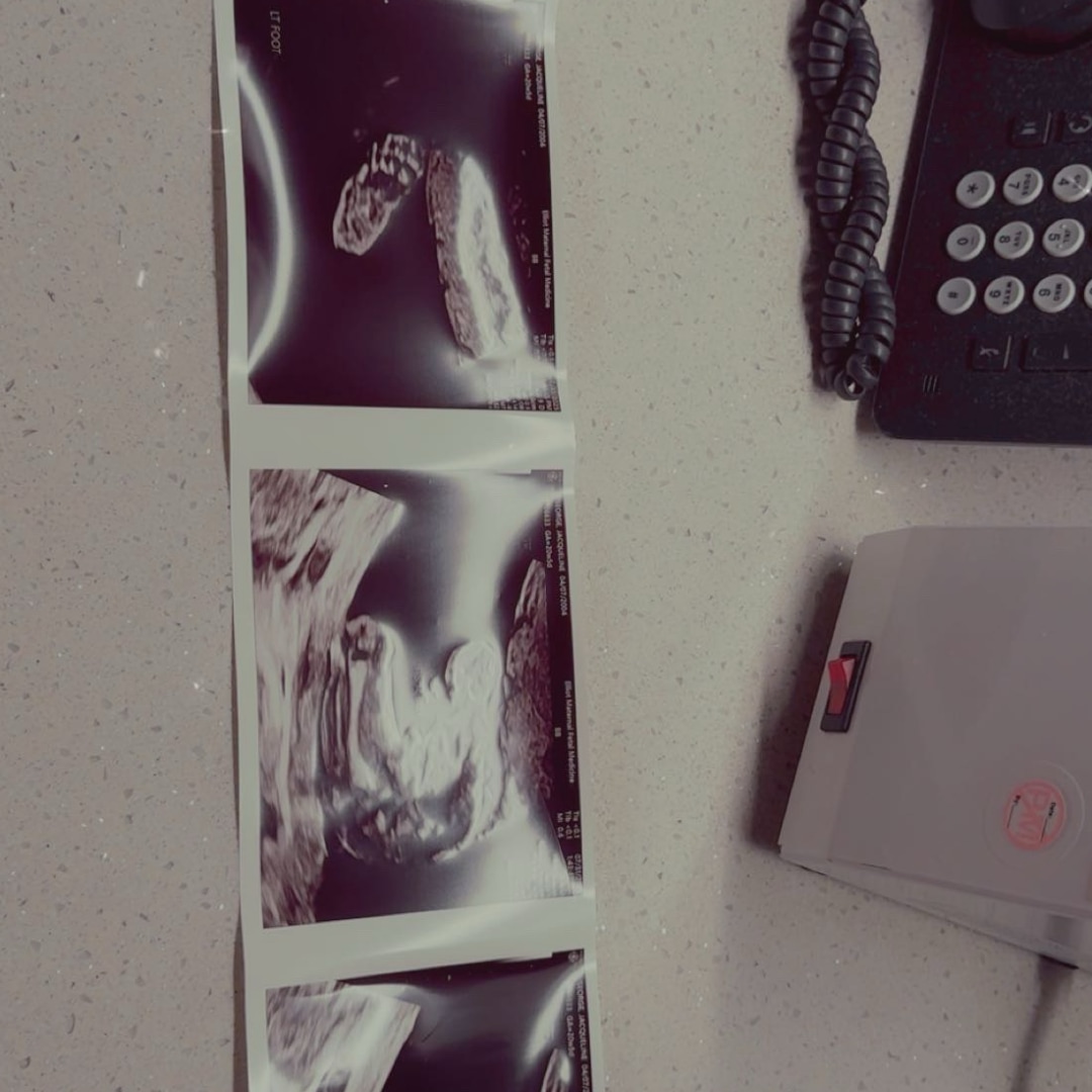 Photo shared by Jackie for their Babylist baby registry.