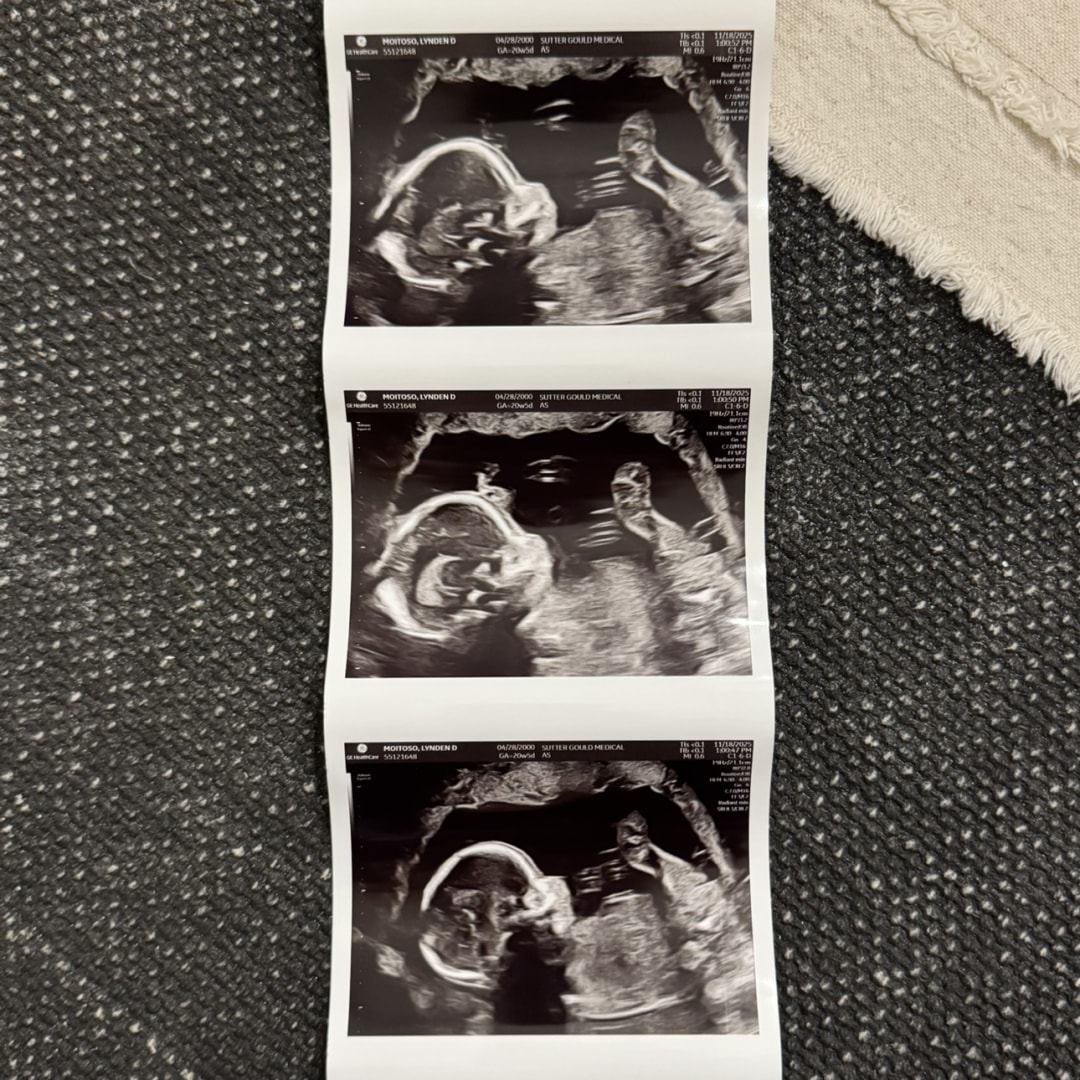 Photo shared by Lynden for their Babylist baby registry.