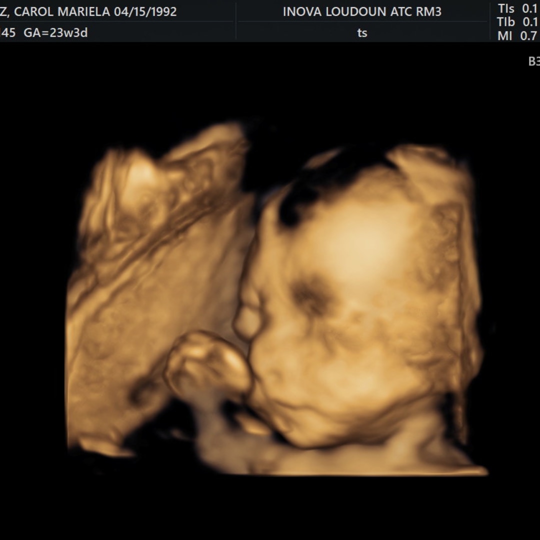 Photo shared by Carol for their Babylist baby registry.