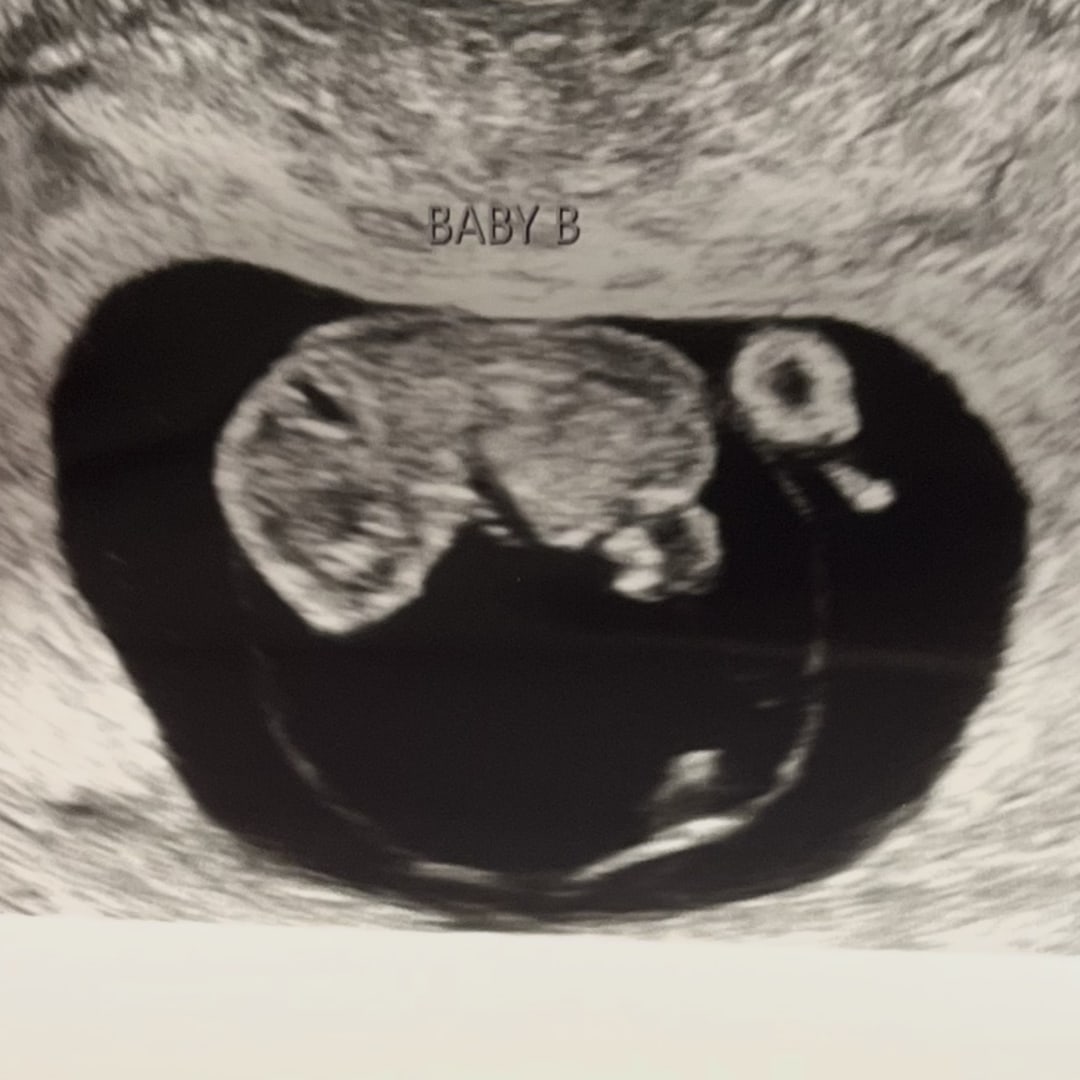 Photo shared by Kara for their Babylist baby registry.