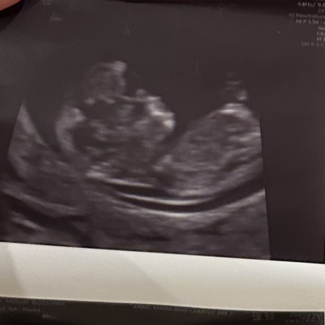 Photo shared by Megan for their Babylist baby registry.