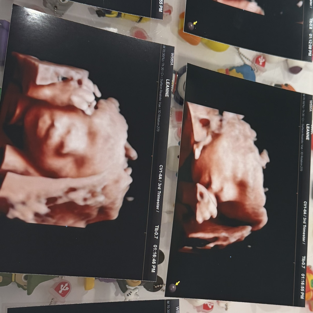 Photo shared by Leanne for their Babylist baby registry.