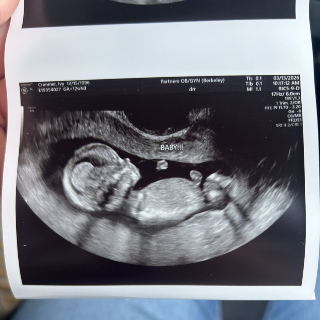 Photo shared by Ivy for their Babylist baby registry.