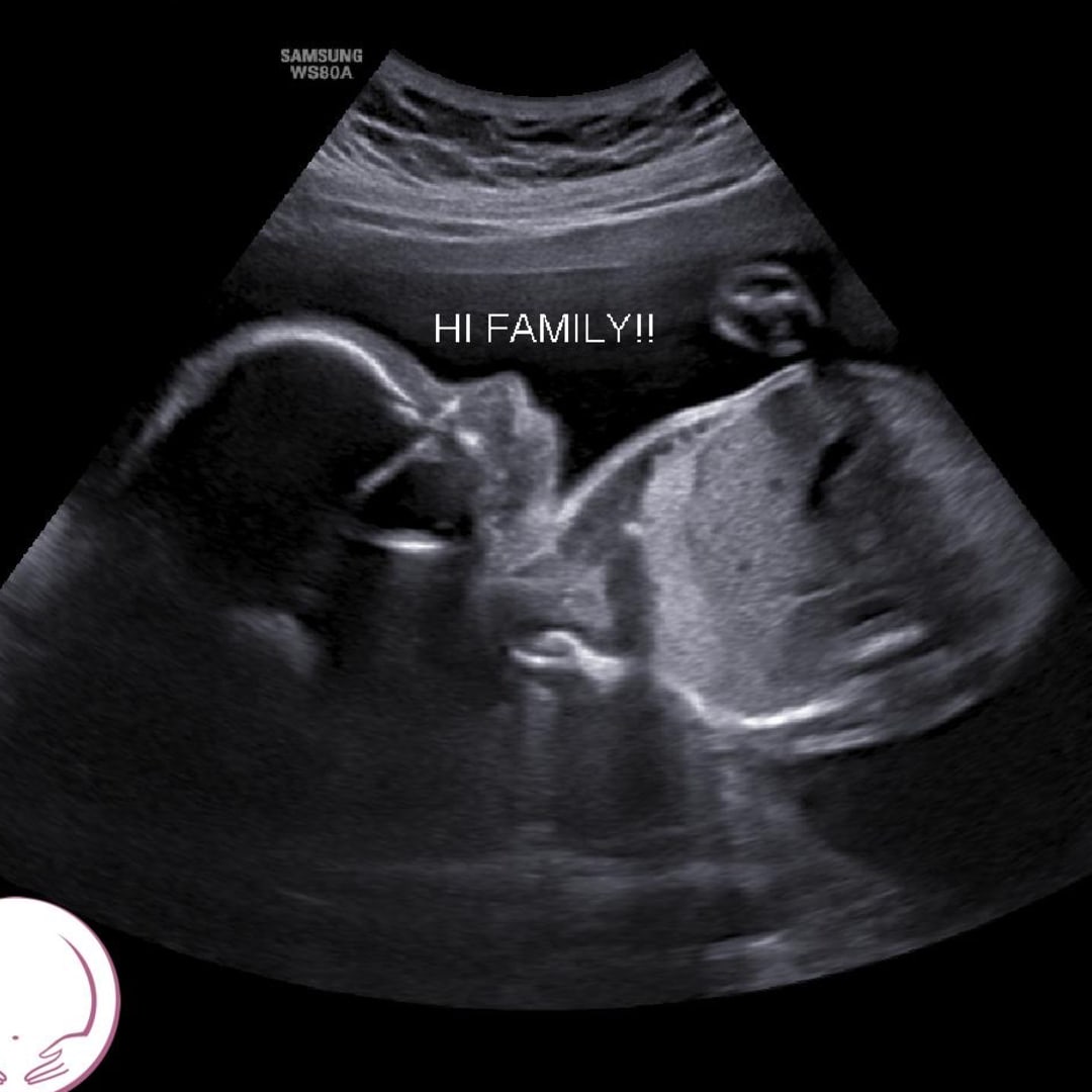 Photo shared by Kayelee for their Babylist baby registry.