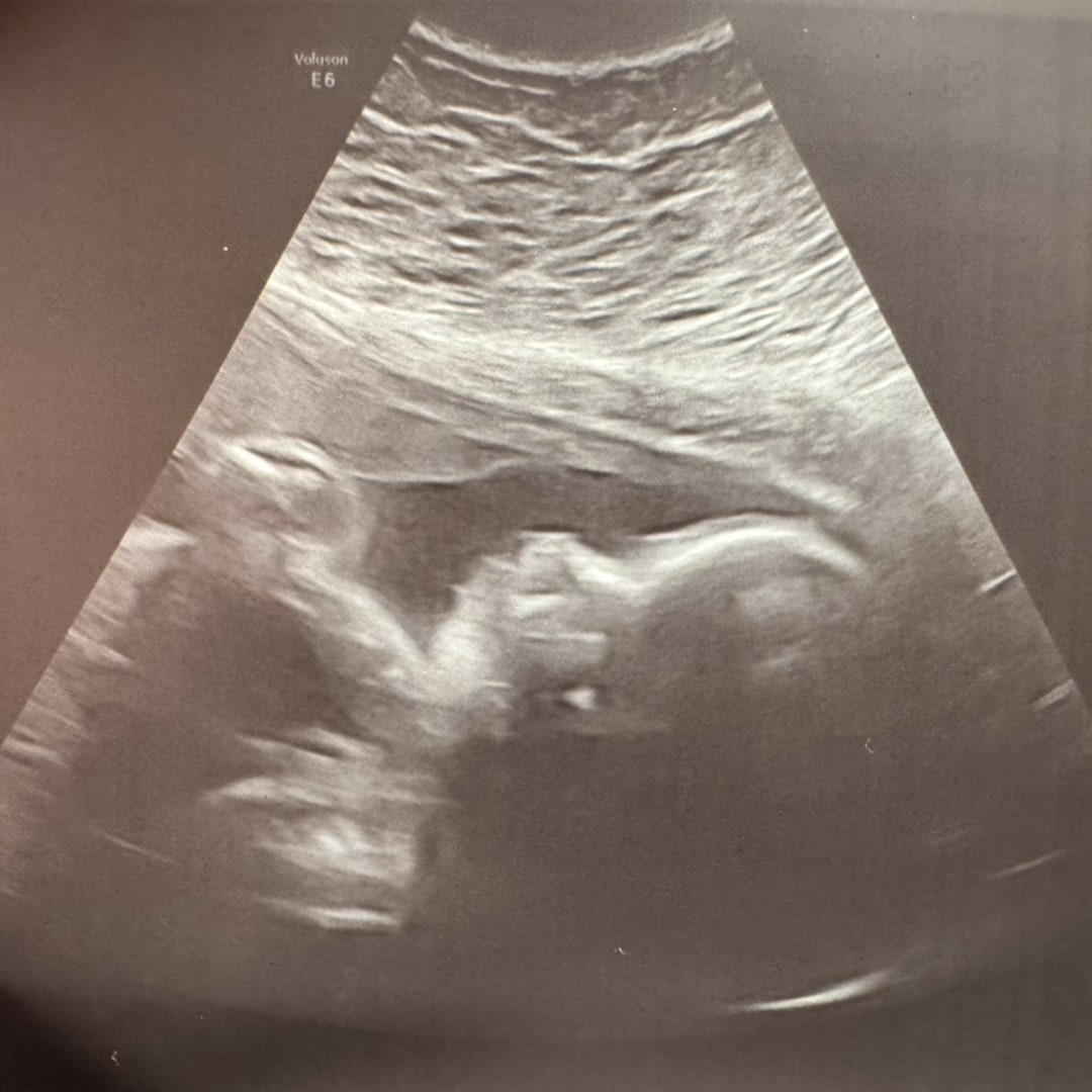 Photo shared by Hayley for their Babylist baby registry.