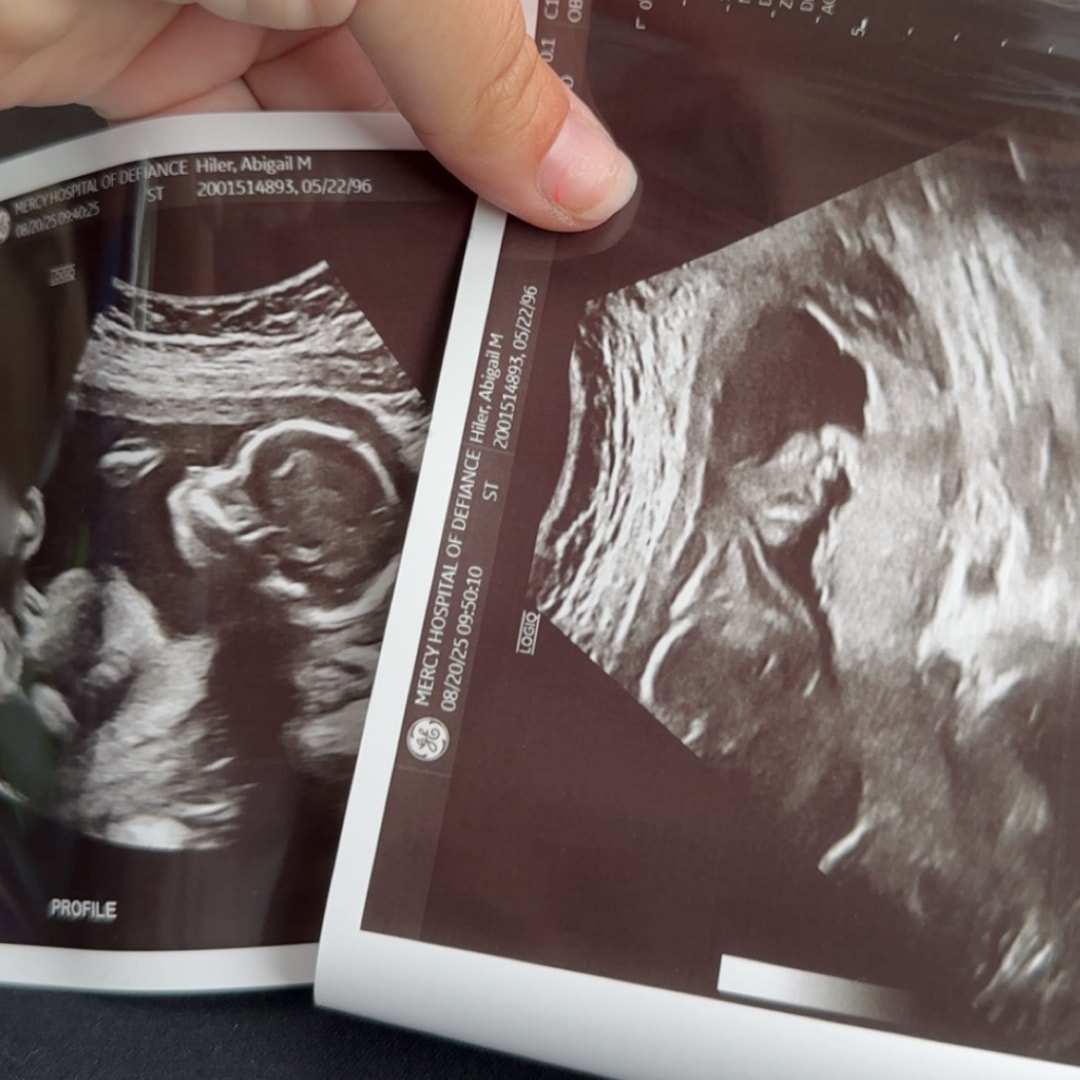 Photo shared by Abigail for their Babylist baby registry.